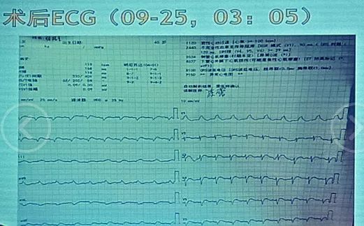 小马拉大车 兄妹