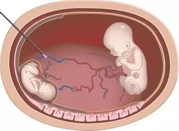 51fun今日吃瓜吃瓜爆料网全网更新最快黑瓜网 全网信息流更新频次高