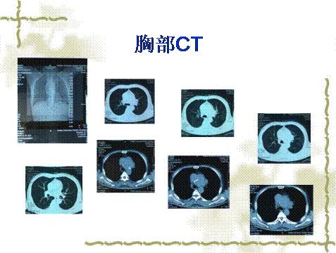 青草国产超碰人人添人人碱
