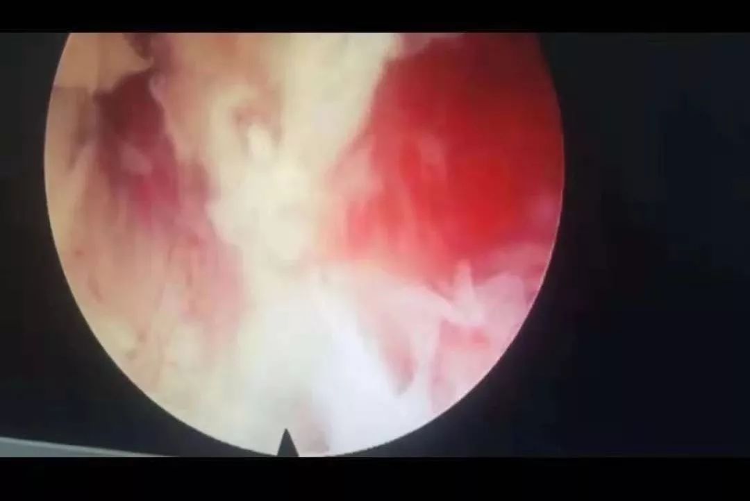 无码国产精品一区二区免费3p 国产监管有时候跟不上