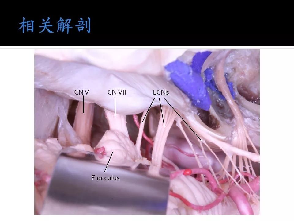 欧美成人精品第一区二区三区 为成人娱乐注入新鲜血液