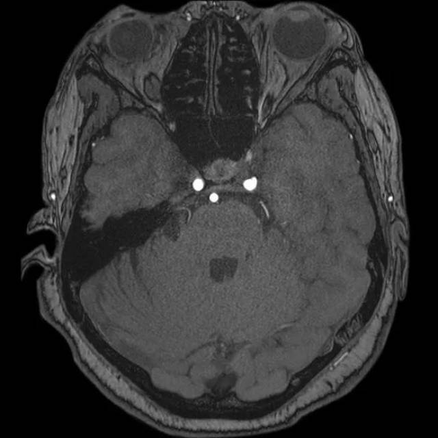 动作视频 具体取决于您的动作视频需求