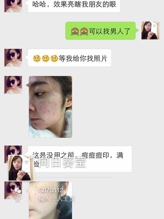 寸止挑战，视频